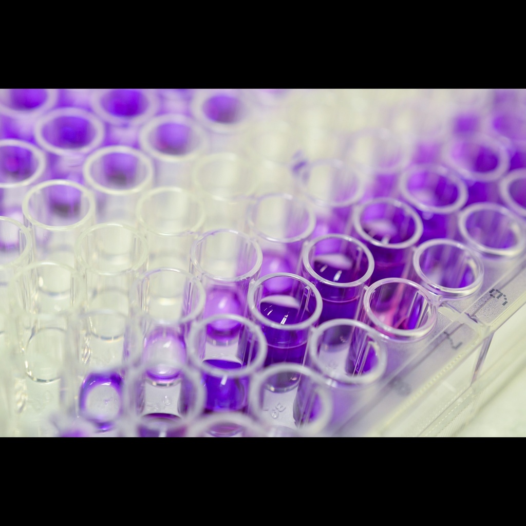 Human procollagen Ⅰ N terminal peptide,PⅠNP ELISA Assay 96 Tests
