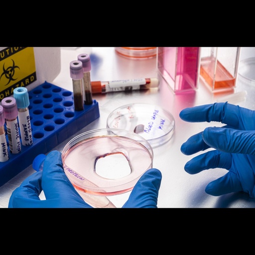 [0146-134511] C Reactive Protein ''CRP'' Endpoint and/or Overnight Radial Immunodiffusion Assay to Quantitate Human Proteins